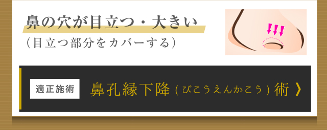 鼻孔縁下降術